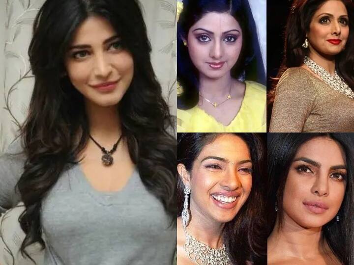 बॉलीवुड में कई ऐसी अभिनेत्रियां हैं, जो अपने खूबसूरत लुक्स के लिए जानी जाती हैं. लेकिन क्या आपको पता है कि इन अभिनेत्रियों ने अपनी खूबसूरती बढ़ाने के लिए नाक की सर्जरी भी कराई है. इन अभिनेत्रियों की लिस्ट में श्रीदेवी, प्रियंका चोपड़ा, शिल्पा शेट्टा सहित कई अन्य शामिल हैं. आइये, इनके बारे में जानते हैं.