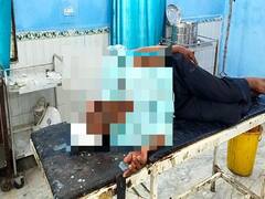 मारपीट से परेशान बेटी को साथ ले जाने पहुंचे थे परिजन, दामाद ने दौड़ा-दौड़ाकर की सभी की पिटाई