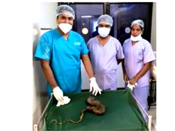 Removal of a tumor weighing 1 kg from the stomach of a school student in vilupuram விழுப்புரம்: தலைமுடியை சாப்பிட்ட பள்ளி மாணவி - 1 கிலோ எடை கொண்ட கட்டி அகற்றம்!