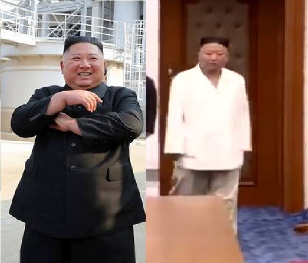 North Korean dictator Kim Jong Un noticeably lost weight, the reason for the weight loss is unclear, Koreans are worried उत्तर कोरियाचा हुकूमशाह Kim Jong Un च्या वजनात घट, नागरिक चिंतेत