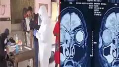 Cytomegalovirus cases: বাড়ল উদ্বেগ! ভারতে খোঁজ মিলল সাইটোমেগালো ভাইরাসে আক্রান্তদের, উপসর্গ কী কী