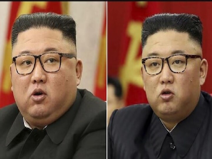 Kim Jong Un Health: என்ன இப்படி இளைச்சுட்டாரு? ஆளே மாறிய கிம்.. கவலையில் ரசிகர்கள்!