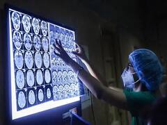 Cytomegalovirus cases: বাড়ল উদ্বেগ! ভারতে খোঁজ মিলল সাইটোমেগালো ভাইরাসে আক্রান্তদের, উপসর্গ কী কী