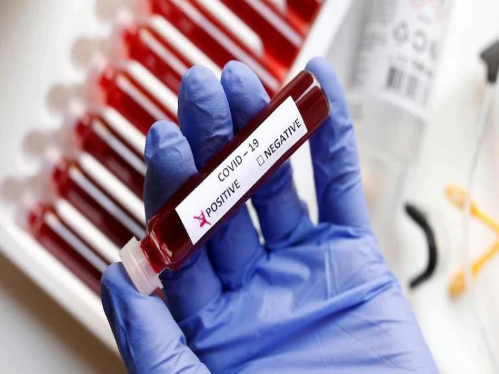Kanchipuram corona viruses update today காஞ்சிபுரம்: 76 பேருக்கு இன்று கொரோனா தொற்று!