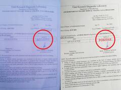 बिहारः जिस कैदी की जिंदा रहते कोरोना की रिपोर्ट निगेटिव आई मरने के बाद हुआ पॉजिटिव