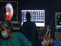 મુંબઈઃ કોરોનાથી સાજા થયા બાદ ત્રણ લોકોમાં બોન ડેથના કેસ સામે આવ્યા, ડોક્ટરોએ હજુ પણ કેસ વધવાની આશંકા વ્યક્ત કરી