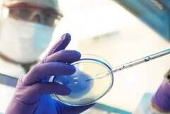 ਚੇਤਾਵਨੀ! ‘ਬਲੈਕ ਫ਼ੰਗਸ’ ਤੋਂ ਬਾਅਦ ਹੁਣ ਭਾਰਤ ’ਚ ਆ ਗਿਆ ‘ਬੋਨ ਡੈੱਥ’ ਰੋਗ