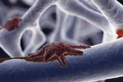 Corona virus: કોરોનાથી સાજા થયેલા દર્દીમાં બ્લેક ફંગસ બાદ હવે આ બીમારીએ વધારી ચિંતા