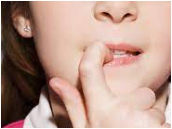 Kids Bad Habits: Nail biting is one of kids bad habits, tips to prevent them Kids Bad Habits: बच्चों की खराब आदतों में से एक है नाखून चबाना, इस तरह करें रोकथाम