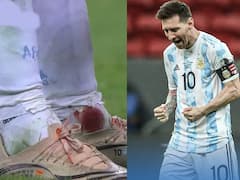 ਪੈਰ ਤੋਂ ਨਿਕਲਦਾ ਰਿਹਾ ਖ਼ੂਨ ਫਿਰ ਵੀ ਖੇਡਦੇ ਰਹੇ Messi