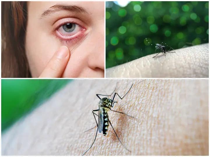 Zika Virus case found in kerala know about dangers of mosquito borne disease Zika Virus : कोरोनानंतर आता झिका व्हायरसची एन्ट्री; डास चावल्याने होणाऱ्या या आजाराबद्दल जाणून घ्या सर्वकाही