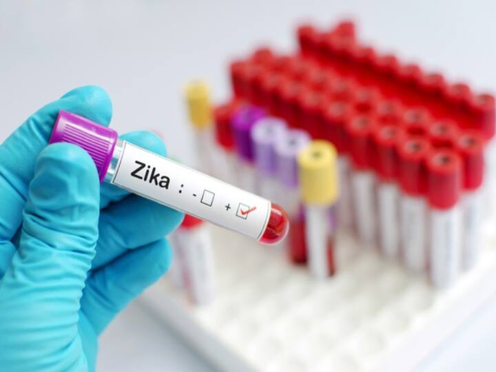 Zika Virus cases in kerala after pregnant woman 14 more cases in kerala now Zika Virus : கர்ப்பிணி ஒருவரைத் தொடர்ந்து கேரளாவில் மேலும் 14 பேருக்கு ஸிகா வைரஸ் பாதிப்பு..!