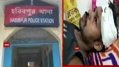 Policeman Injured: মাছ চুরিতে বাধা, হরিশচন্দ্রপুরে দুষ্কৃতী-হামলায় জখম পুলিশকর্মী