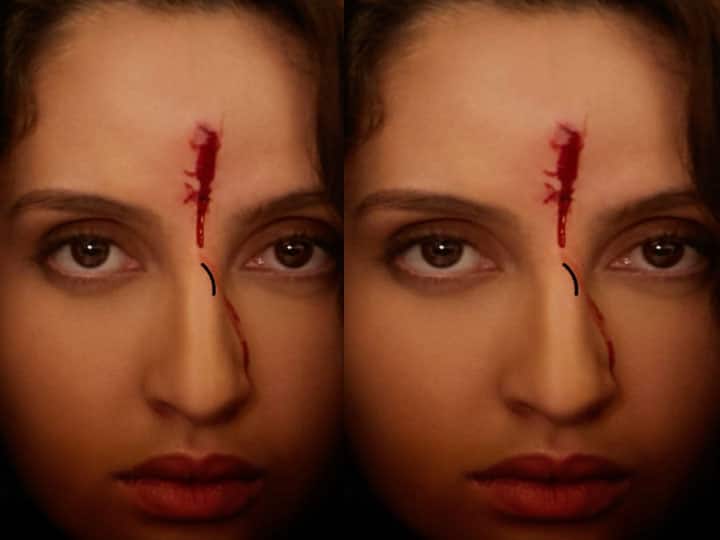 Nora Fatehi News Blood coming out of the forehead, What kind of wound did Nora Fatehi get? know the reason of this picture Nora Fatehi को मिला ये कैसा ज़ख्म? माथे से निकलता दिखा खून, वजह जानकर हो जाएंगे खुश?