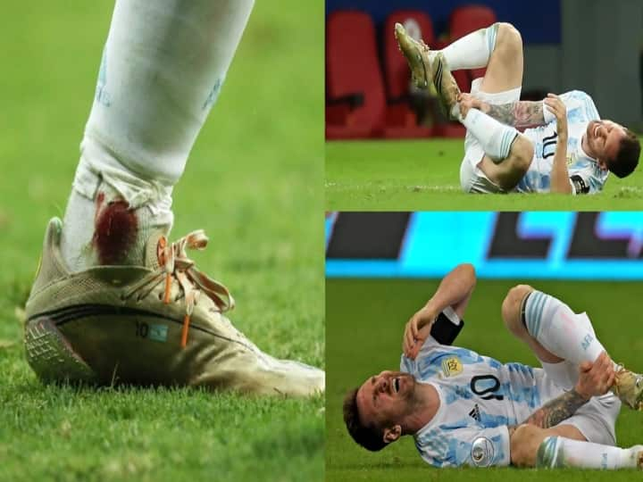 Lionel Messi Plays With A Bleeding Ankle During Copa America Semifinal