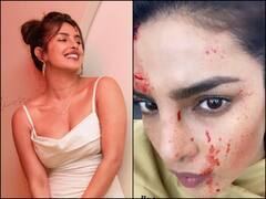 Priyanka Chopra Drops 'Bloody-Faced' Selfie From Sets Of Citadel, Says 'You Should See...'