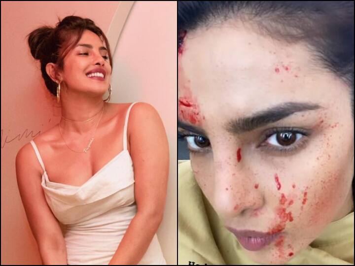 Priyanka Chopra Drops 'Bloody-Faced' Selfie From Sets Of Citadel, Says 'You Should See...' Priyanka Chopra Drops 'Bloody-Faced' Selfie From Sets Of Citadel, Says 'You Should See...'