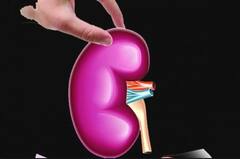 Kidney Problems:'সাইলেন্ট কিলার' হয়ে উঠতে পারে কিডনির অসুখ, অবহেলা করা উচিত নয় এই লক্ষণগুলি