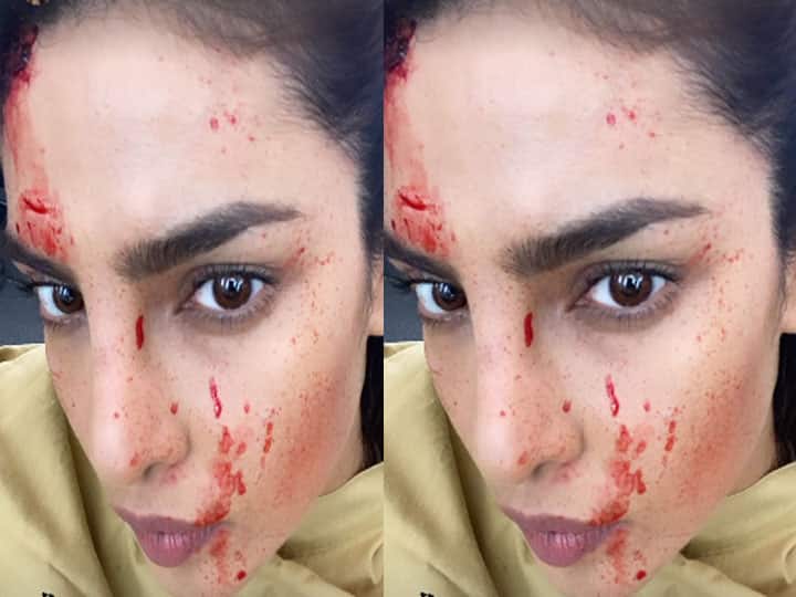 Priyanka Chopra के चेहरे पर 'खून' के छींटे देख परेशान हुए फैंस, वायरल हुई देसी गर्ल की ये तस्वीर, जानें क्या है माजरा?