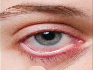 Eye Care Tips: Be Careful Before It's Too Late, These Indicators Point Towards Blurred Vision