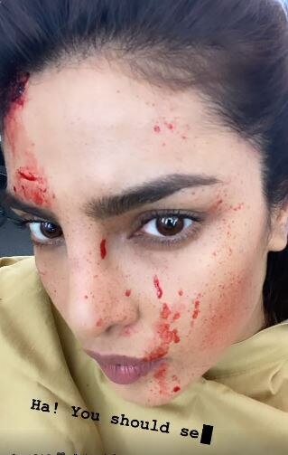 Priyanka Chopra Drops 'Bloody-Faced' Selfie From Sets Of Citadel, Says 'You Should See...