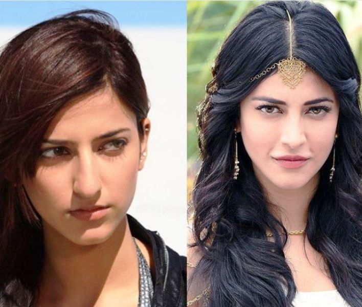 After And Before Pictures Of Actress Shruti Haasan | प्लास्टिक सर्जरी के बाद कितना बदल गईं हैं श्रुति हासन, देखिए पहले और बाद की तस्वीरें