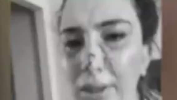 Daughter of Afghan envoy to Pakistan tortured brutally: Medical Report