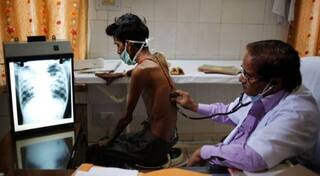 કોરોનાથી ઠીક થયેલાના થઈ શકે છે આ ગંભીર રોગ, જાણો મોદી સરકારે શું કહ્યું ?