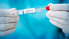 Covid Updates: রাজ্যে কমল দৈনিক আক্রান্তের সংখ্যা, একদিনে আক্রান্ত ৮০১