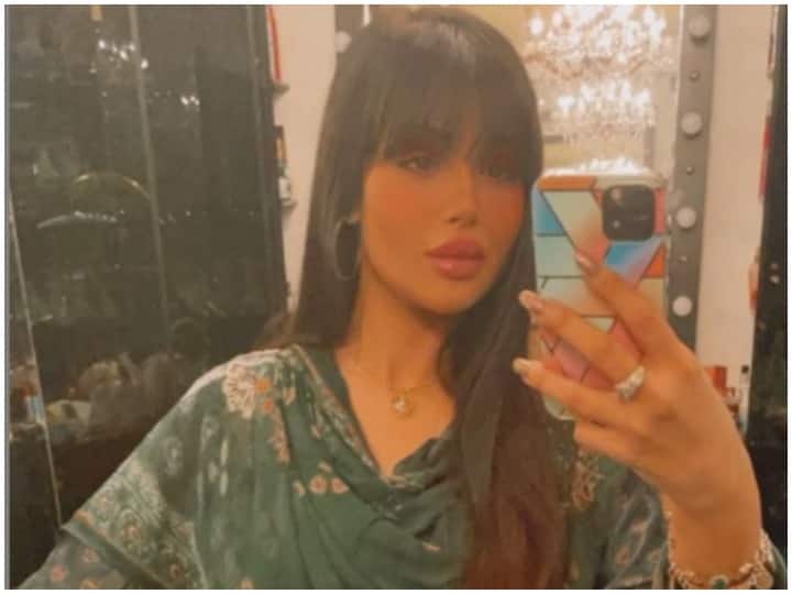 Ayesha Takia trolled after she post her a video in which she appears with lip surgery Lip Surgery: अनुष्का शर्मा के बाद इस मशहूर हीरोइन ने कराई होंठो की सर्जरी, पहचानना भी हुआ मुश्किल
