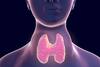 Thyroid Problem: Have These Foods If You Have Initial Symptoms