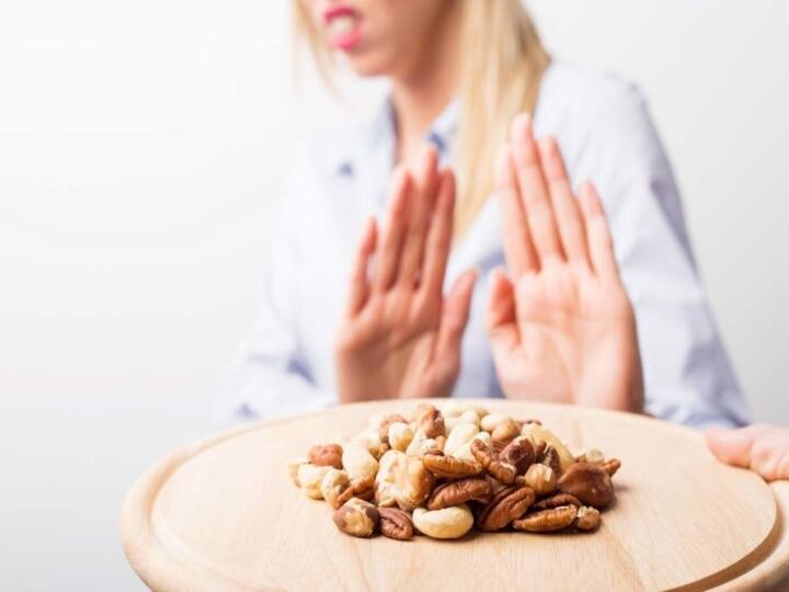 The Most Common Food Allergies, Know in details Food Allergies : ফুড অ্যালার্জি কী ? কীভাবে বুঝবেন ?