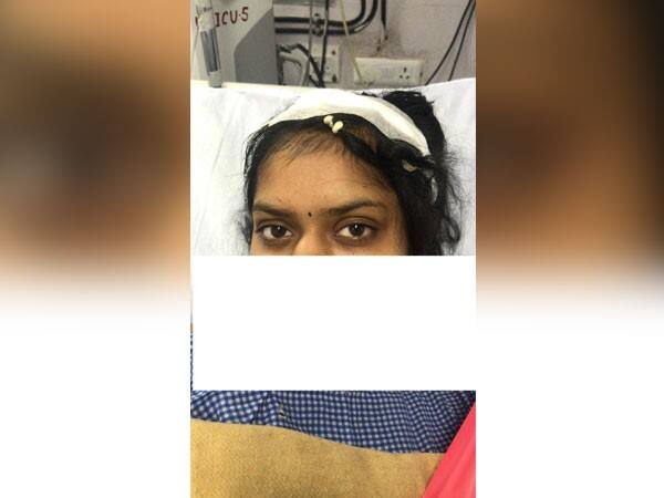 Woman chants Hanuman Chalisa during brain tumor surgery  in AIIMS ब्रेन ट्यूमर सर्जरी के दौरान युवती करती रही हनुमान चालीसा का जाप, दिल्ली एम्स में हुआ सफल इलाज