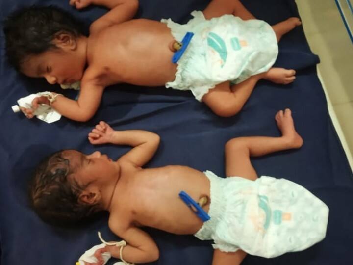 The mother gave birth to twins while Corona was suffering சிவகங்கை: எத்தனை, எத்தனை கஷ்டம்..? கொரோனாவை வென்ற கர்ப்பிணிக்கு இரட்டைக்குழந்தை!
