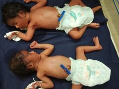 சிவகங்கை: எத்தனை, எத்தனை கஷ்டம்..? கொரோனாவை வென்ற கர்ப்பிணிக்கு இரட்டைக்குழந்தை!