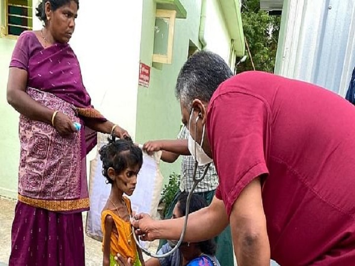 பிளீச்சிங் பவுடர் உண்ட சிறுமியின்  குடும்பத்துக்கு,  அமைச்சர் மா.சுப்பிரமணியன் செய்த உதவி என்ன?