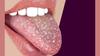Tongue Cleaning Tips: সুস্থ শরীরের জন্য খুবই গুরুত্বপূর্ণ জিভ পরিষ্কার রাখা, জানুন কেন ?
