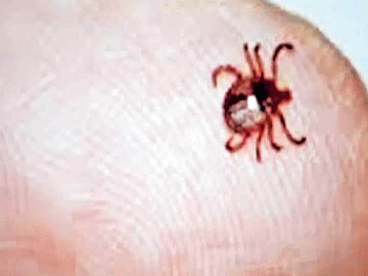 Scrub Typhus: कोरोना के बीच नए खतरे की आहट? आईजीएमसी शिमला में मिले स्क्रब टायफस के चार मरीज, जानें क्या है ये बीमारी