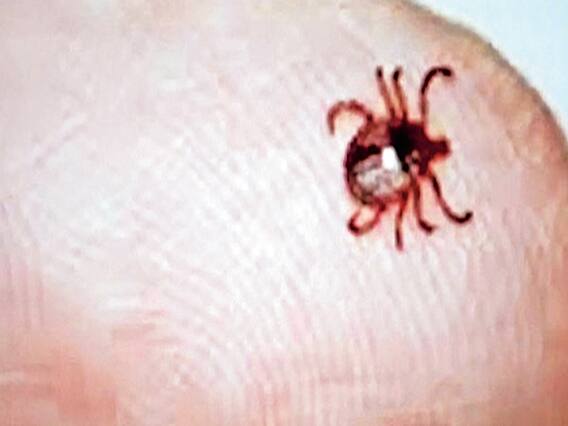 Scrub Typhus: कोरोना के बीच नए खतरे की आहट? आईजीएमसी शिमला में मिले स्क्रब टायफस के चार मरीज, जानें क्या हैं इसके लक्षण Scrub Typhus: कोरोना के बीच नए खतरे की आहट? आईजीएमसी शिमला में मिले स्क्रब टायफस के चार मरीज, जानें क्या हैं इसके लक्षण