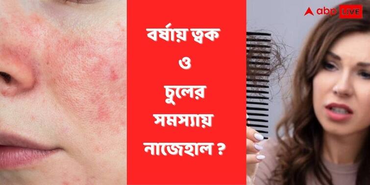Skin Hair Problem In Monsoon, Know the disease & remedies Dermatologists share views Skin Problem In Monsoon: সারা গায়ে র‍্যাশ? মাথা চুলকে নাজেহাল? বর্ষার বিড়ম্বনা এড়াতে কী করবেন?