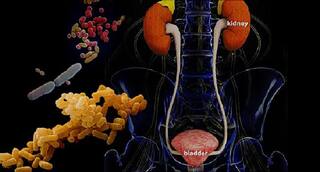 Urinary Tract Infection | அடிக்கடி சிறுநீர் பாதை தொற்று ஏற்படுகிறதா? தடுப்பது எப்படி? சிகிச்சை முறைகள் என்னென்ன?