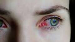 Mucormycosis : मुंबईत म्युकरमायकोसिसचा धोका झाला कमी, 904 रुग्णांपैकी 571 रुग्णांना डिस्चार्ज