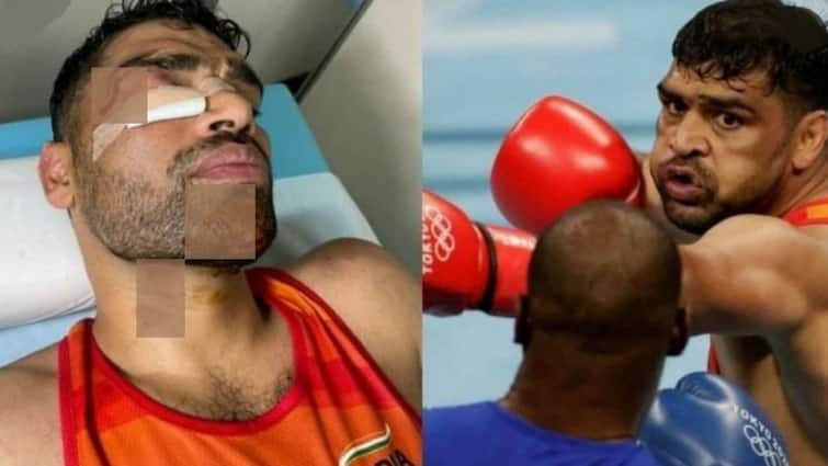 Tokyo Olympics 2020: Satish Kumar loses to Bakhodir Jalolov of Uzbekistan Tokyo Olympics 2020: রক্তাক্ত মুখে দুরন্ত লড়াই, ম্যাচ হারলেও মন জিতলেন সতীশ কুমার