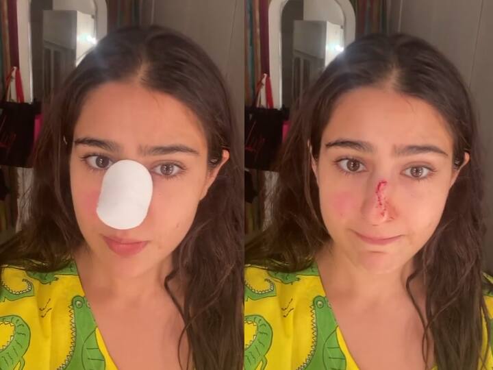 Actress sara ali khan shares video on social media said sorry ammi abba naak kaat di maine  બોલીવૂડ  અભિનેત્રી  સારા અલી ખાન શૂટિંગ દરમિયાન થઈ ઈજાગ્રસ્ત, નાક  પર પહોંચી ઈજા, જુઓ વીડિયો 