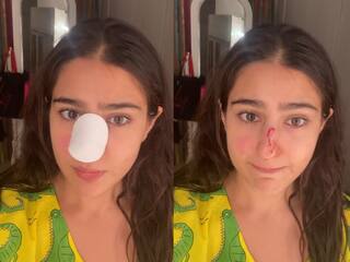 બોલીવૂડ  અભિનેત્રી  સારા અલી ખાન શૂટિંગ દરમિયાન થઈ ઈજાગ્રસ્ત, નાક  પર પહોંચી ઈજા, જુઓ વીડિયો 