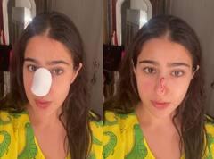 Sara Ali Khan शूटिंग के दौरान हुईं घायल, नाक पर लगी चोट, वीडियो बनाकर खुद दिखाया जख्म