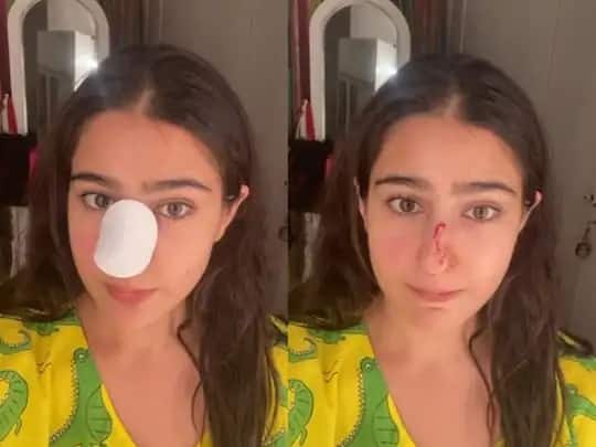 Video Viral: actress sara ali khan shares a video of her nose injured બૉલીવુડની કઇ હૉટ એક્ટ્રેસે જાતે જ કાપી નાંખ્યુ પોતાનુ નાક, ને પછી કોની પાસે માંગવા લાગી માફી, વીડિયો વાયરલ