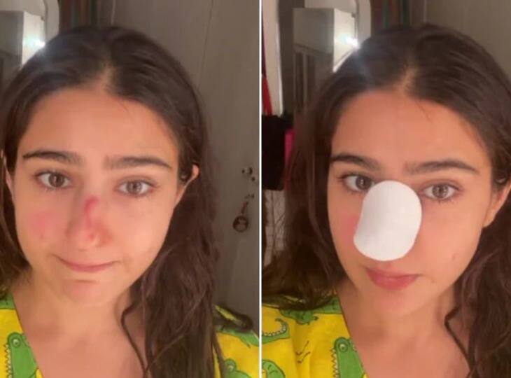 Sara Ali Khan की नाक में लगी थी चोट, अब बुआ Saba Ali Khan ने बताया उनका हाल