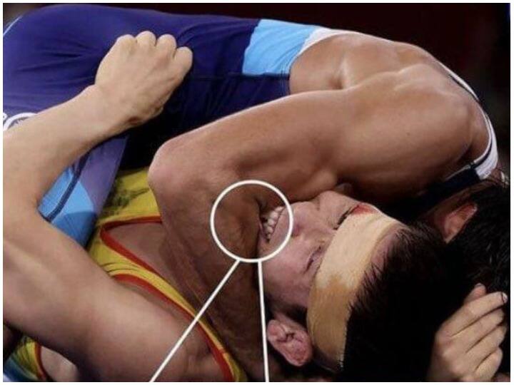 Tokyo Olympics 2020 Photos of Kazakhstani wrestler biting Ravi Dahiya with teeth went viral Virender Sehwag furious Tokyo olympics 2020: कजाकिस्तानी पहलवान का रवि दहिया को दांतों से काटने की तस्वीरें वायरल, वीरेंद्र सहवाग समेत लोग भड़के