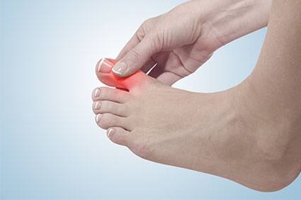 યુરીક એસિડ વધી જાય છે? તો ડાયટમાંથી આ વસ્તુઓને કરો દૂર. થશે રાહત